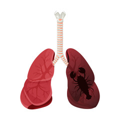 Illustration of lung smoker, lung cancer disease. The concept of stop smoking. Vector illustration.