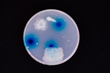 Petri dish with colonies of bacteria in a microbiology laboratory