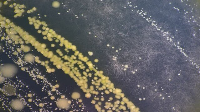 Timelapse of the growth of bacteria and microorganisms in a petri dish on agar.