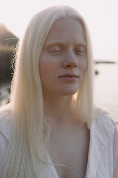 portrait of an albino girl 