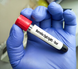 Blood sample tube for Borrelia IgG and IgM test, Lyme disease diagnosis.