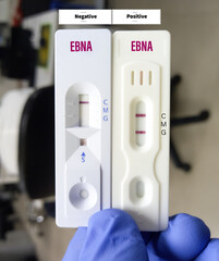 Rapid test cassette for EBNA (Epstein-Barr Virus Nuclear Antigen) antibody test, to diagnose EBV infection, show positive and negative result, medical testing concept.