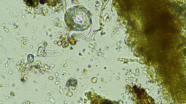 soil microbes in a soil sample on a sustainable agricultural farm in australia