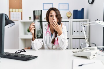 Young doctor woman holding foot x-ray covering mouth with hand, shocked and afraid for mistake....