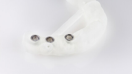 surgical dental template on a white background for the installation of three implants