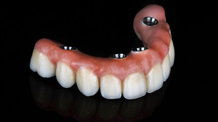 upper jaw prosthesis made of ceramic with pink gingiva and titanium, photographed against a black background © Dental Pro Content