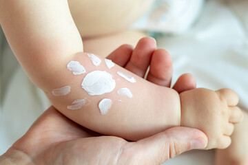 cute little baby hand and sun shape drawn with protective cream.toddler with red burned skin,sun damage.sunblock protective cream long lasting.daddy hand holding childs hand.vacation,sea