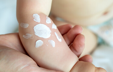 cute little baby hand and sun shape drawn with protective cream.toddler with red burned skin,sun...