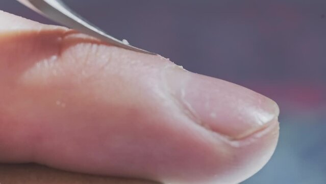 Male finger with dry skin during the process of removing of the hangnails using the scissors.