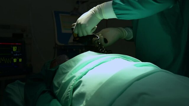 A team of doctors in the operating room performs CPR on a patient who is suffering from shock from heart failure.
