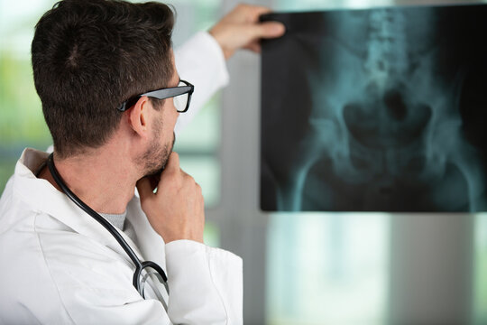 radiologist man checking a xray