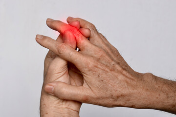 Inflammation of Asian man middle finger and hand. Concept of arthritis or cellulitis.