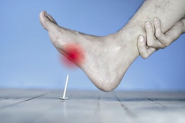 Nail prick injury in foot of Asian young man. Concept of tetanus.