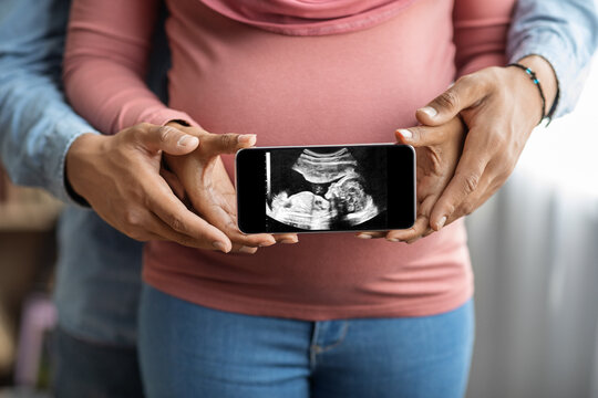 Unrecognizable black pregnant couple holding smartphone with their baby sonography photo