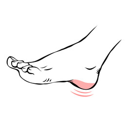 Line sketch female leg with problematic pain. Sore heel. Orthopedic disease plantar fasciitis. Beauty and health of feet. Vector isolated outline illustration