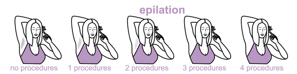 armpit hair removal, arm hair removal, hardware destruction of hair follicles, laser hair removal, sugaring, procedure for women and men