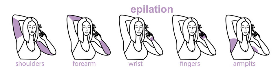 arm epilation zones, laser hair removal, women's hair follicle removal procedure, dark hair, ingrown hairs in the armpits and on the arms