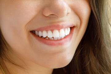 Beautiful female smile. Healthy white teeth of a young woman.