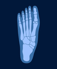 X-ray of human foot bones. Human joint anatomy x-rays vector illustration.