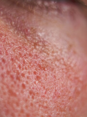 close up of skin