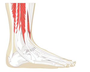 High Ankle Sprain Diagram