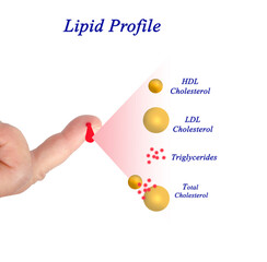 Desirable range of Lipid profile