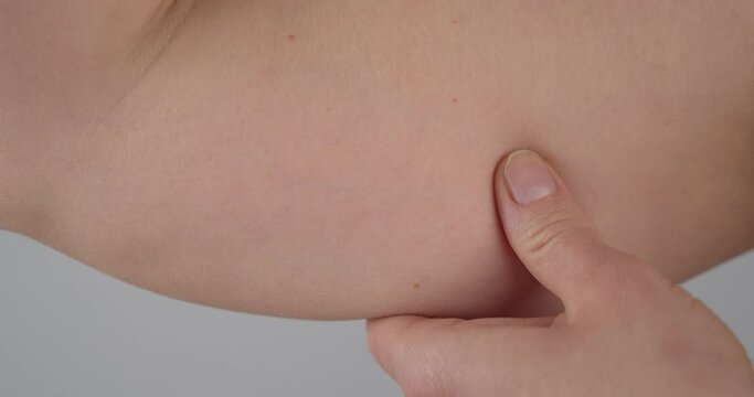 Close up shot of of a woman pinching the skin beneath her arm. Showing her fatty arm which needs to get reduced. No face
