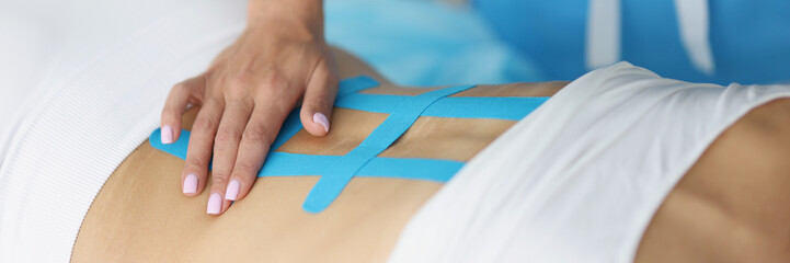 Doctor holding x ray of womans back and correct kinesiology tape