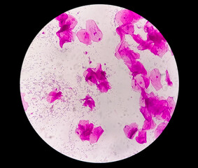 bacteria Gram staining under microscope