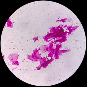bacteria Gram staining under microscope