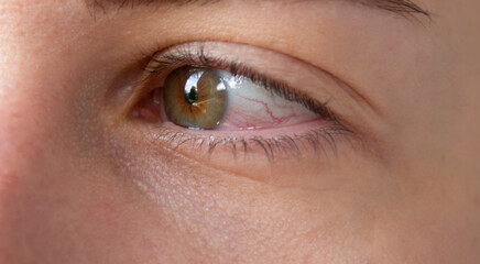 Fototapeta na wymiar close up of a female red eye