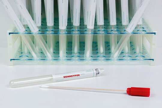 Test PCR pour dépistage de la variole du singe.
