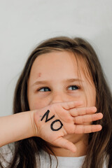  portrait of little scared bruised girl raising hand to cover mouth, showing inscription no on open...