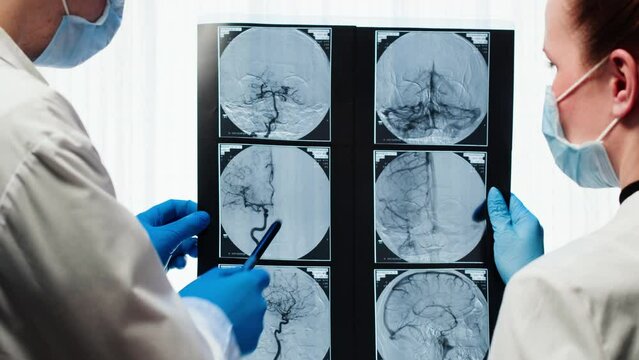 Doctors examining X-ray,brain MRI. Magnetic resonance image of head. Therapist and nurse looking at human blood vessels close-up. Advanced research of body, checkup tomography. 