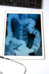 X-ray image of the intestine in the tablet. The concept of telemedicine and diagnosis of diseases