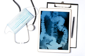 X-ray image of the gastrointestinal tract in a tablet. The concept of telemedicine and diagnosis of diseases