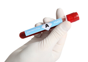 Obraz premium Scientist holding tube with blood sample and label Hepatitis A Test on white background, closeup