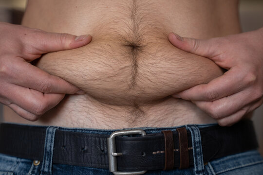 Adult man hands touch fat belly crease. Plump man concerned about being overweight. Appendicitis scar on man fat stomach. Bare belly extreme closeup