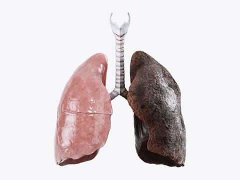 Realistic 3d illustration of healthy human lungs vs smoker lungs isolated on white background. Front view of human lungs before and after smoking 