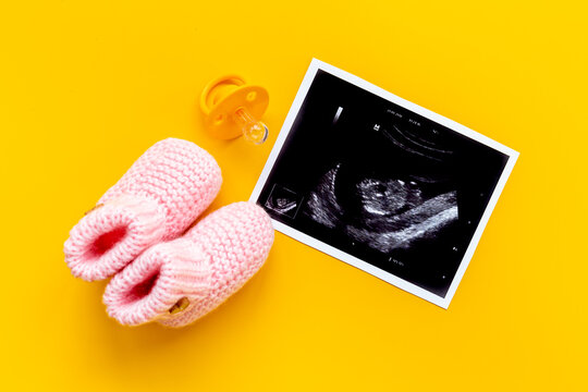 Pregnancy background. Baby accessories with ultrasound picture of unborn baby