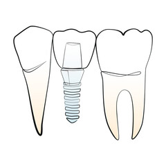 Natural and artificial teeth line art on white isolated background