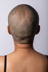 Abstract portrait. Woman standing back to camera with shaved head in white studio background with...