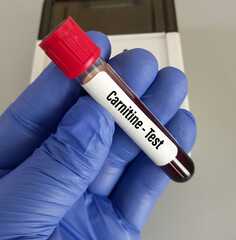 Scientist hold blood sample for Carnitine blood test, Carnitine helps the body convert fats into...