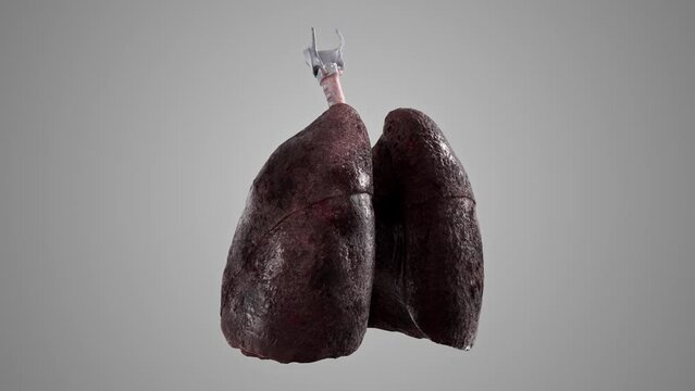 Turntable 3d animation of smoker lungs with trachea isolated. Human sick lungs anatomy