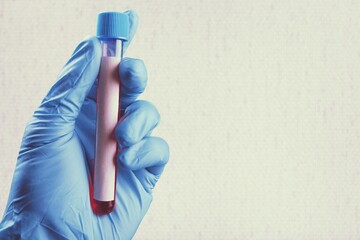 Blood sample for Genetic test, known as mutations,