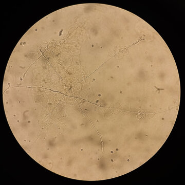 Microscopic view of hyphae of dermatophytes. fungus test. skin scraping, Diagnosis for fungal infection.