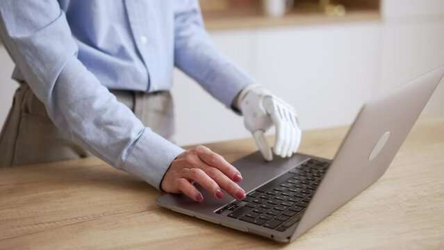Close view of young woman with bionic hand is using laptop and standing at table at home spbas. 4k American female freelancer types on keyboard of device and does online job or studies at desk in