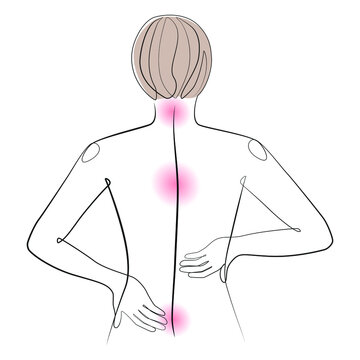 recommend clip art: Woman back line art, human spine health on white isolated background. Back pain syndrome vector illustration 