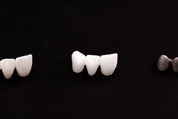 Teeth implant and crown installation process parts isolated on a black background. Medically...