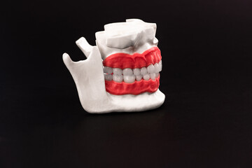 Human jaw with teeth and gums anatomy model isolated on blue background. Healthy teeth, dental care and orthodontic medical healthcare concept